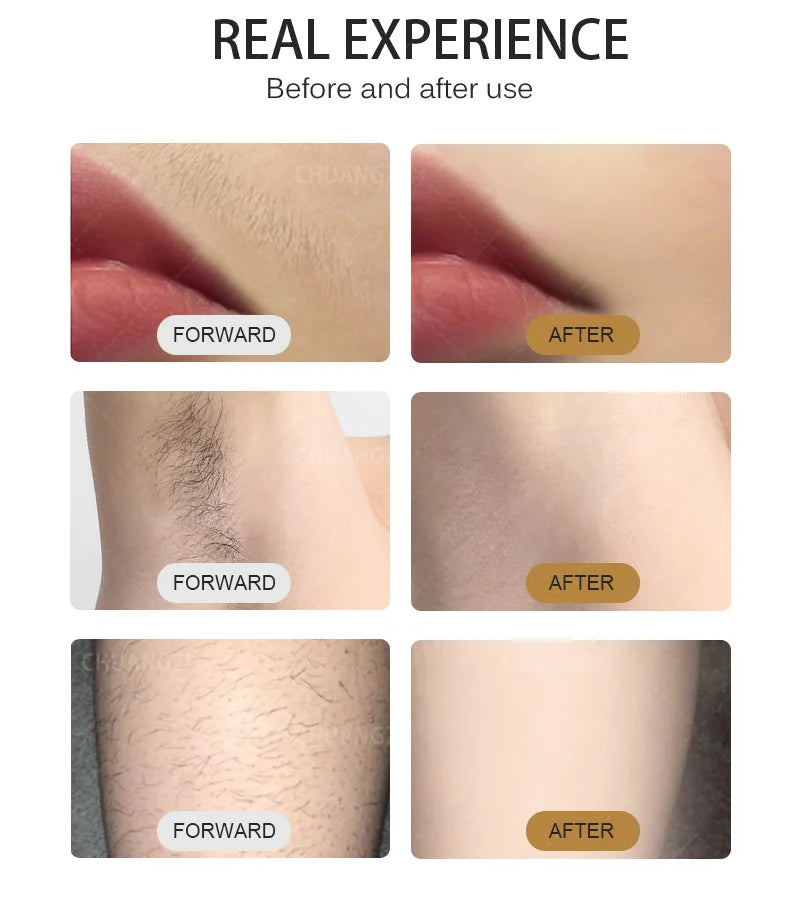 Diode Laser Hair Removal Machine Depiladora Laser 808NM 755NM 1064NM Tender Skin Safe Painless Permanent Depilation High Power