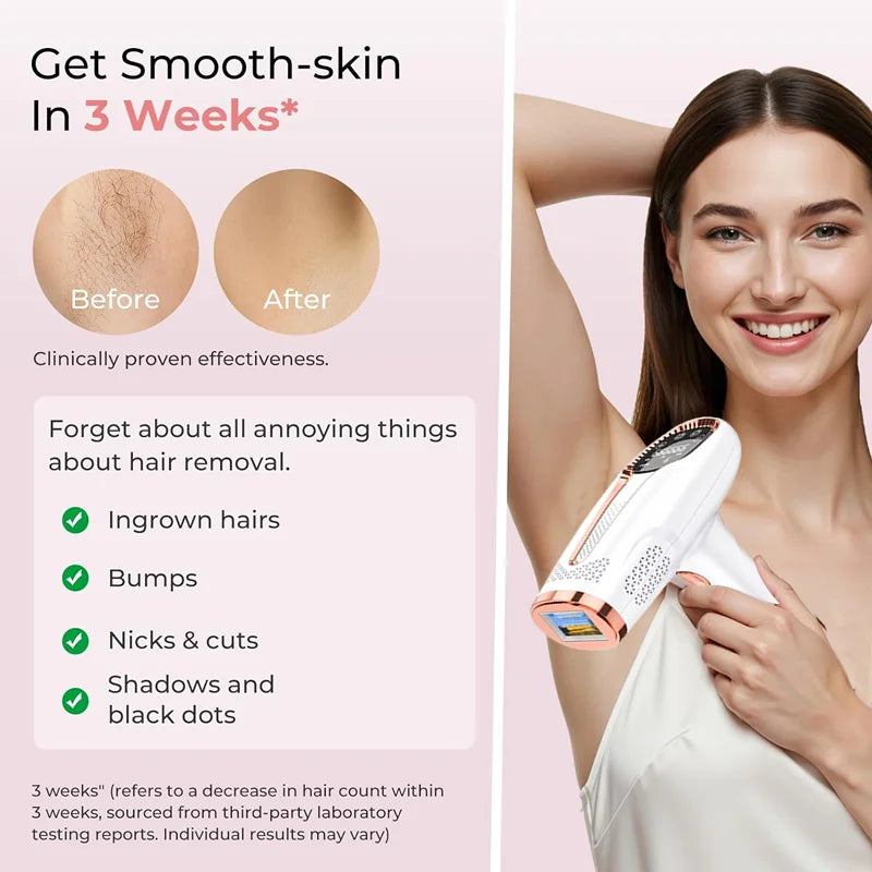 4-in-1 Laser Epilator Laser Hot Sell Permanent IPL Photoepilator Hair Removal Painless Electric Epilator Machine