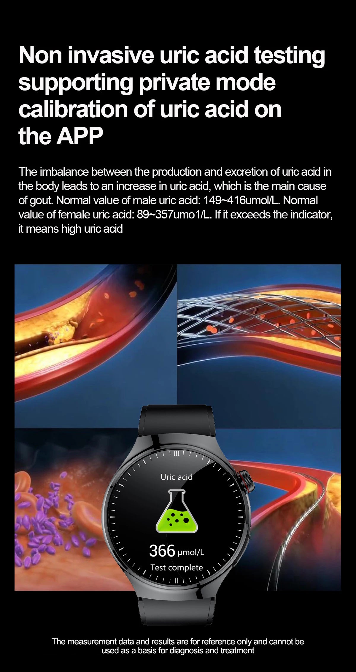 2025 For HUAWEI Precise ECG+PPG Uric acid HD Smart Watch Men Blood lipids Heart Rate Blood pressure Sport Call Health Smartwatch