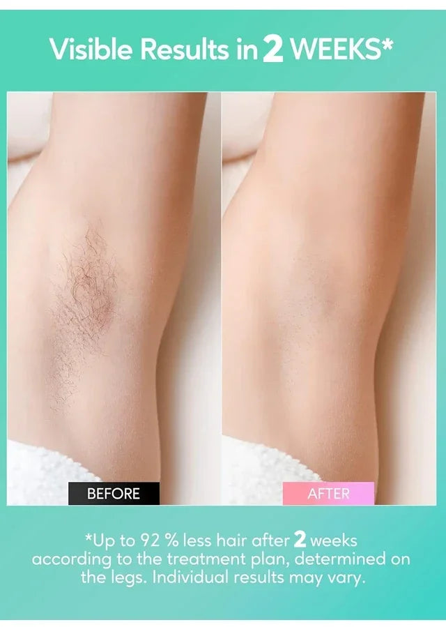 4-in-1 Laser Epilator Laser Hot Sell Permanent IPL Photoepilator Hair Removal Painless Electric Epilator Machine