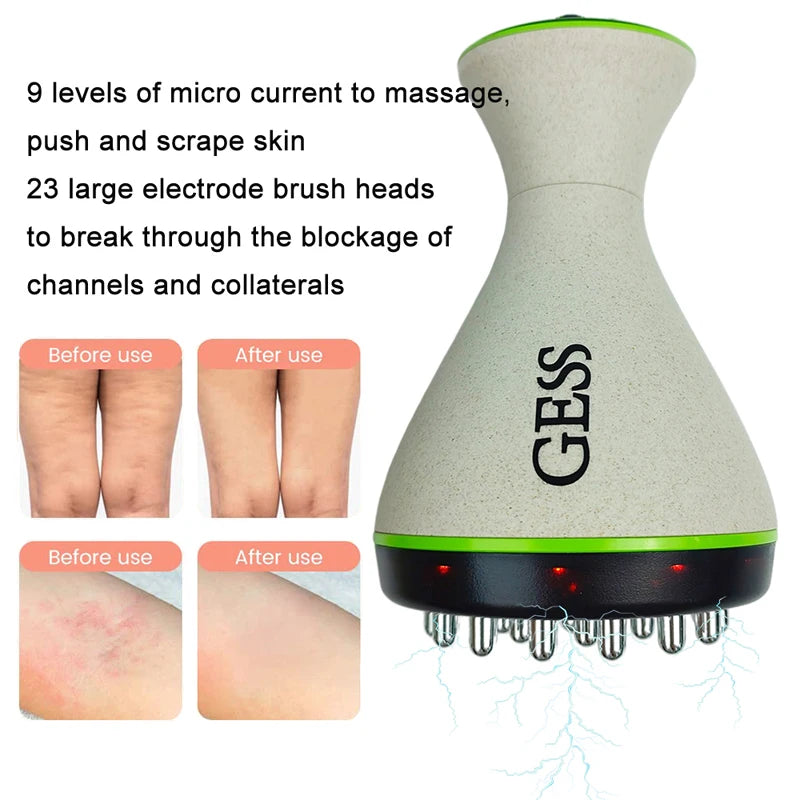 GESS Microcurrent Cellulite Massager, Heating Vibration Handheld Lymphatic Drainage Massager, Electric Meridian Massage Brush